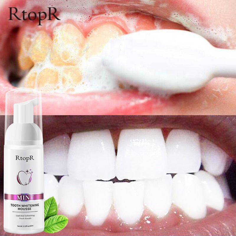 Tooth Whitening Mousse - My Store