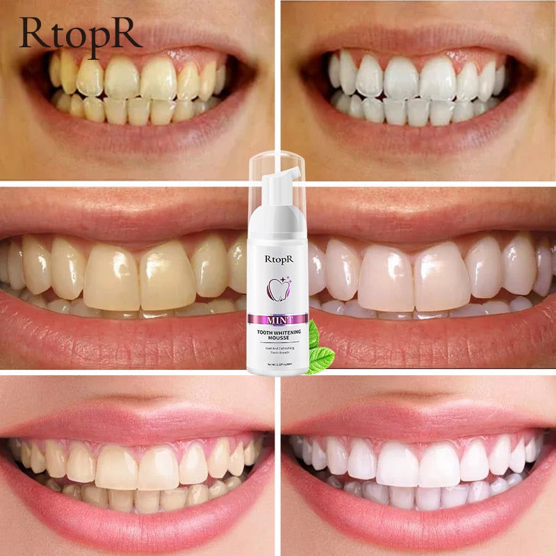 Tooth Whitening Mousse - My Store