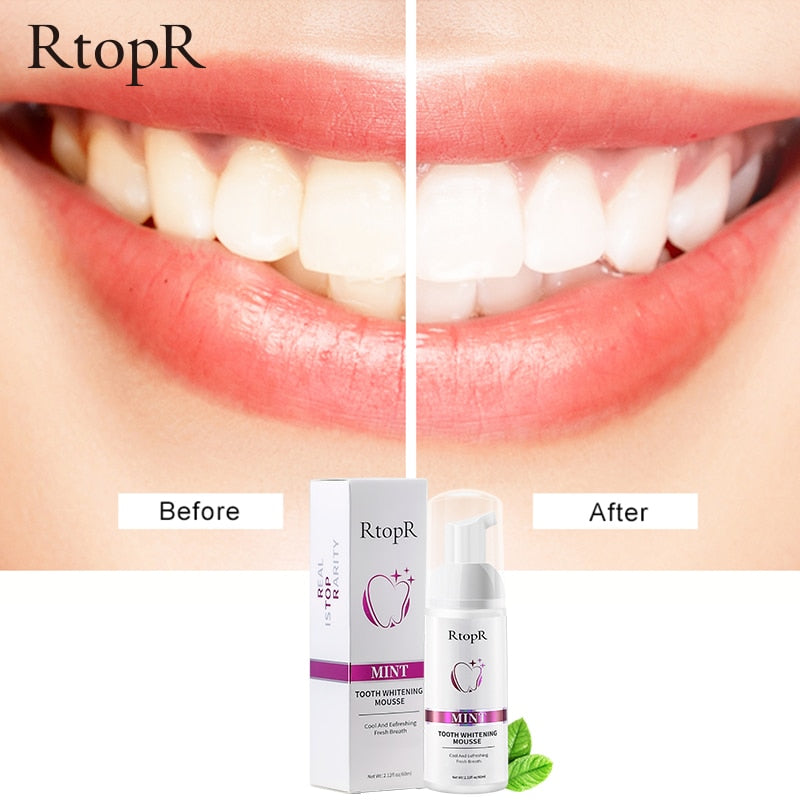 Tooth Whitening Mousse - My Store